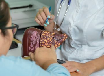 Cirrose hepática: entenda o que é e quais são os sintomas e o tratamento