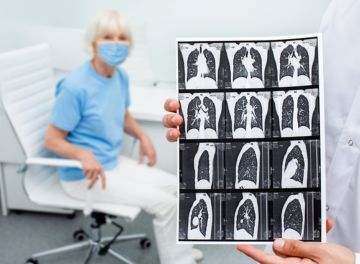 Fibrose pulmonar