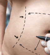 Cirurgia abdominal: quando é indicada e como funciona a preparação