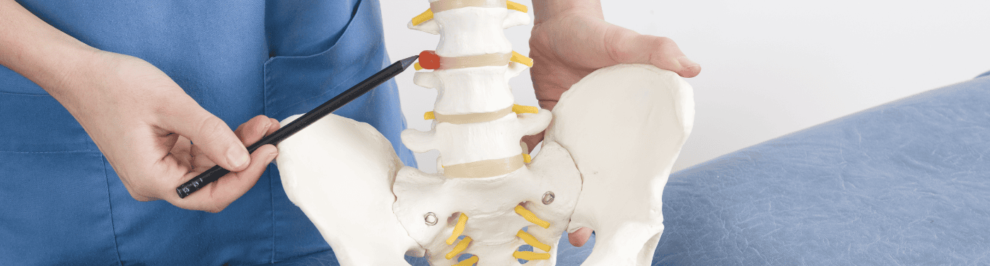 Hérnia de disco: entenda as causas, sintomas e tratamentos