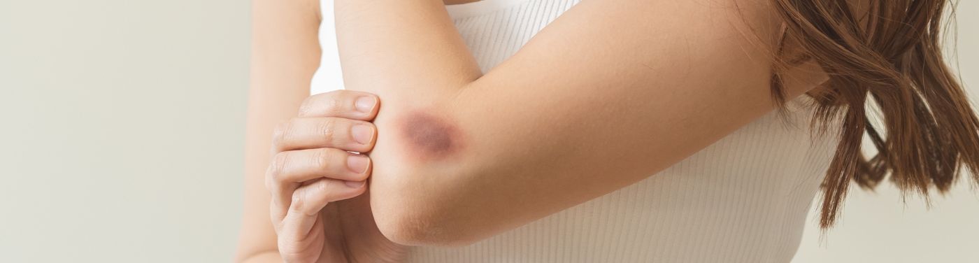 púrpura trombocitopênica imunológica