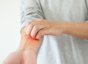 Alergia na pele