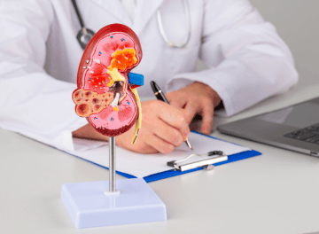 calculo renal