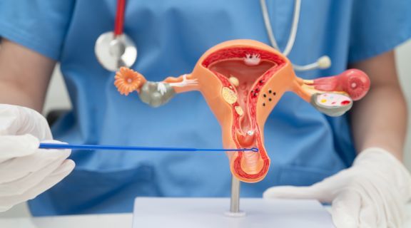 causas de câncer na vagina e útero​