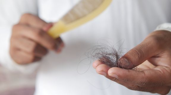 como amenizar queda de cabelo por hipotireoidismo___.jpg