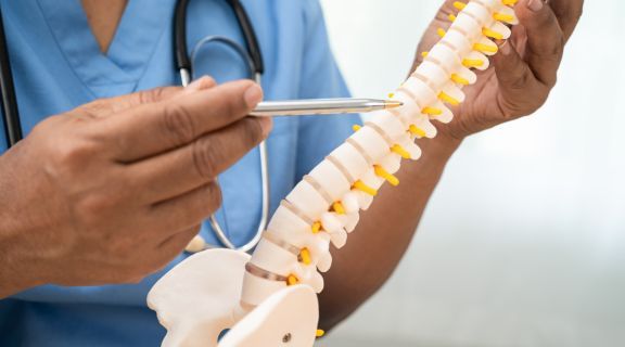 como tratar bico de papagaio na coluna​
