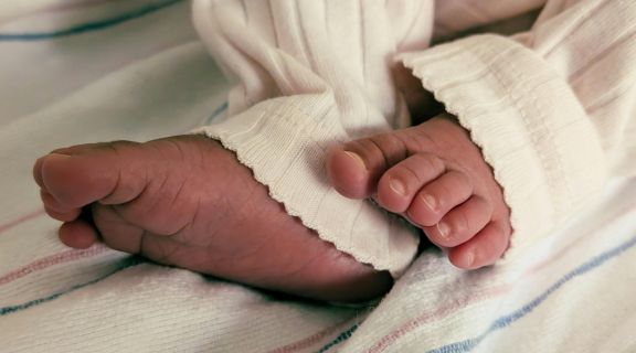 displasia do quadril no recém-nascido.jpg