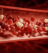 doencas hematologicas
