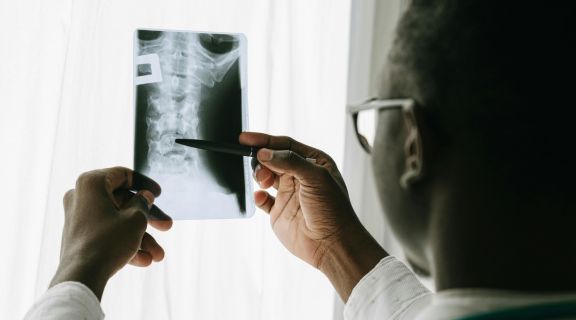 edema da medula óssea_.jpg