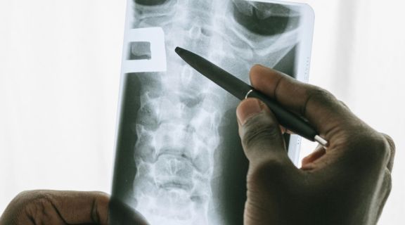 edema medular ósseo.jpg