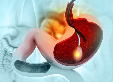 endoscopia