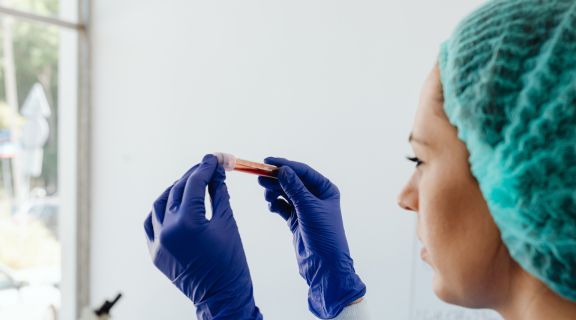 Médica checando exame de sangue