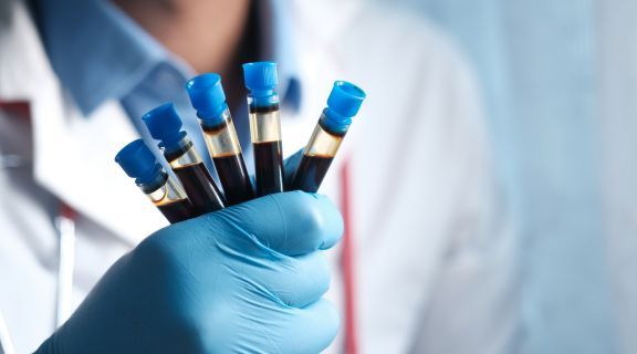 exames para artrite reumatoide