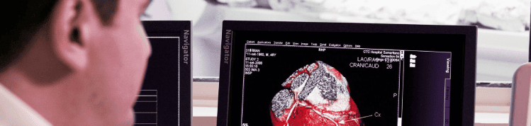 hospital-higienopolis-cardiologia-1680x400-angiotomografia.png