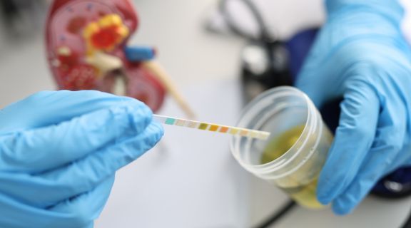 infecção nos rins aparece no exame de urina