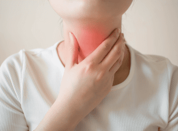 iodoterapia