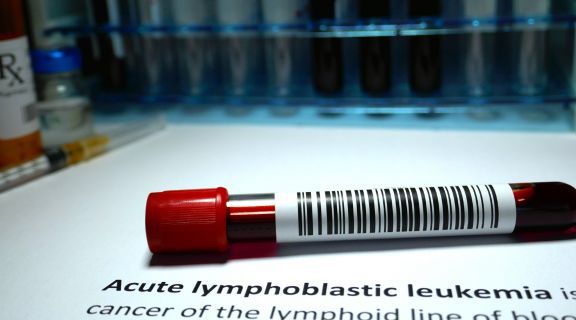 leucemia linfoblástica aguda