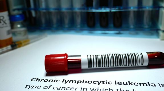 leucemia linfocítica crônica​