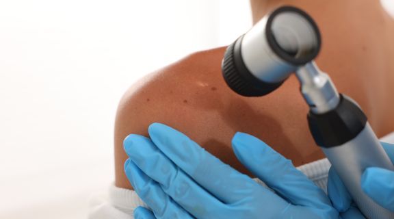 medico dermatologista em campinas unimed especialista em oncologia