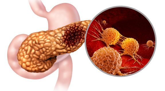 medicos oncologista especialista em cancer do estomago maringa