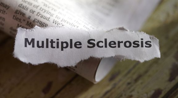 o que causa esclerose múltipla