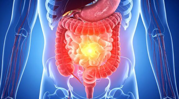o que é disbiose intestinal