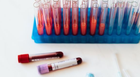 o que pode ser sangue oculto nas fezes