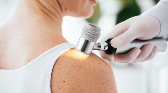 oncologista especialista em melanoma rio de janeiro​