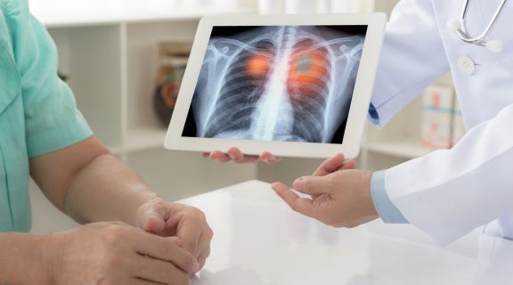oncologista especialista em pulmão rj