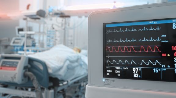 onde fazer ecg