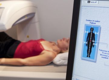 Osteopenia: causas, sintomas e prevenção