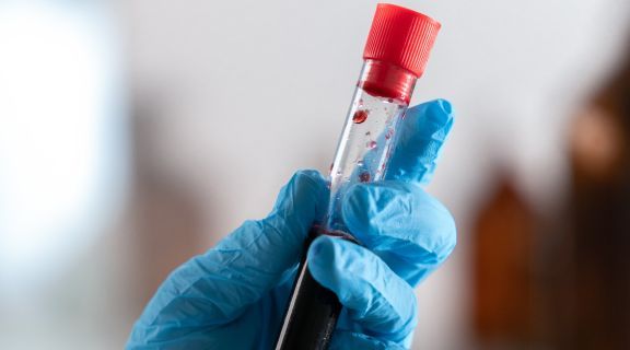 para doar medula óssea precisa ter o mesmo tipo sanguíneo.jpg