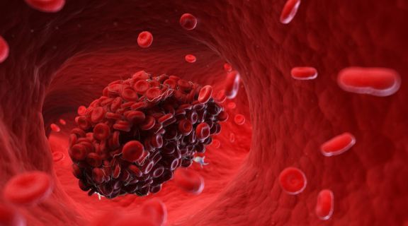 problemas de coagulação do sangue