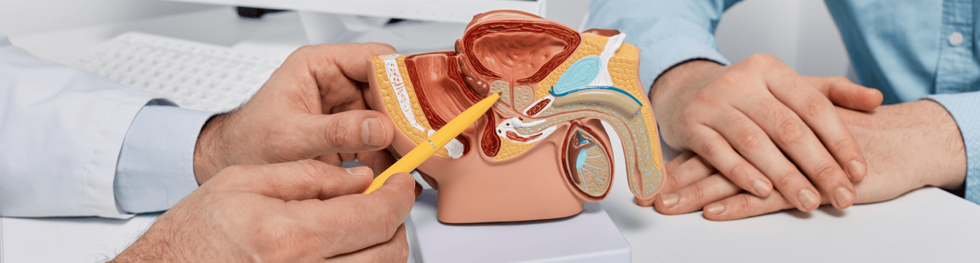 Prostatectomia radical: o que é, quando é indicada, tipos e pós-cirúrgico