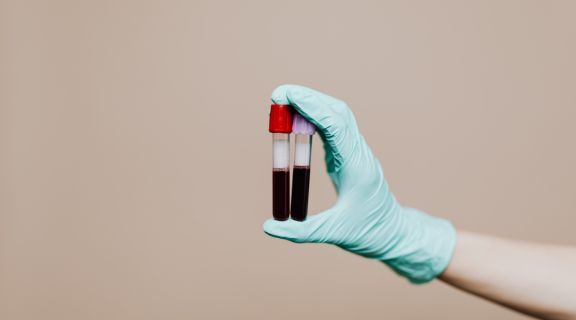 qual exame de sangue detecta linfoma de hodgkin