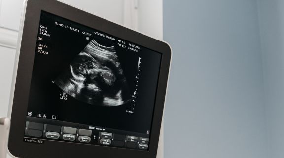 qual exame faz primeiro mamografia ou ultrassonografia​