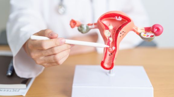 quem fez histerectomia pode ter cancer​