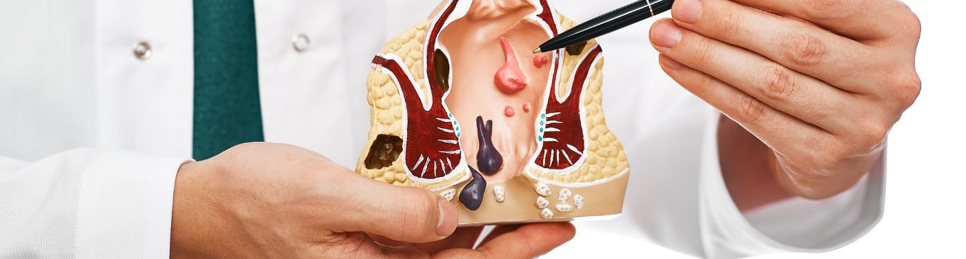 Sangue nas fezes: causas, sintomas relacionados e o que pode indicar