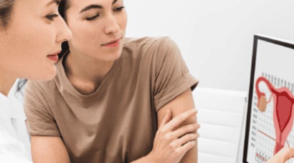 Câncer de colo de útero: tudo o que você precisa saber