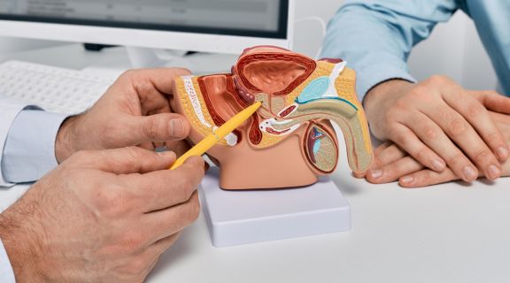 Como ocorre o câncer de próstata: saiba como reconhecer os sinais