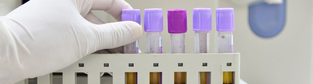 É possível detectar o câncer pelo hemograma completo1.jpg