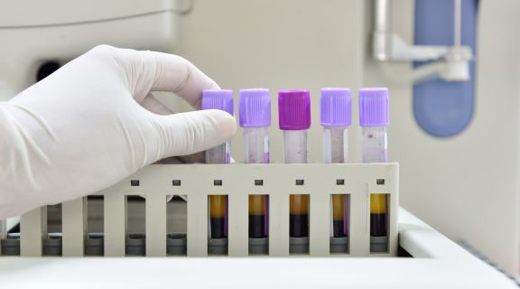 É possível detectar o câncer pelo hemograma completo?