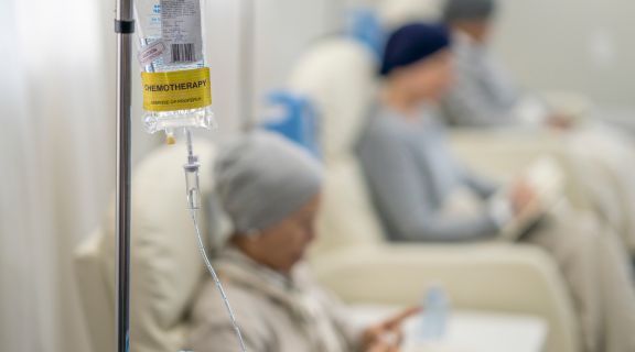 Efeitos da segunda sessão de quimioterapia: o que esperar e como se preparar