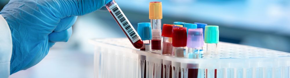 Exame de sangue para detectar câncer1.jpg