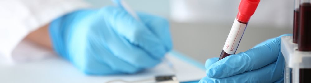 Exame de sangue que detecta câncer no intestino1.jpg