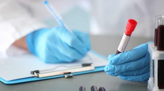 Como funciona o exame de sangue que detecta câncer no intestino