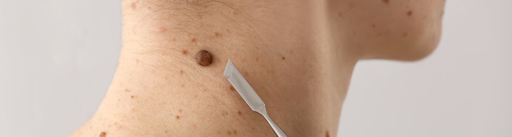 Pintas que podem ser câncer1.jpg