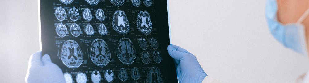 Quais os sintomas de tumor na cabeça1.jpg