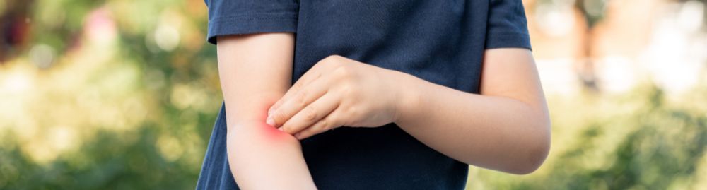 Qual a melhor pomada para picada de inseto em bebê1.jpg