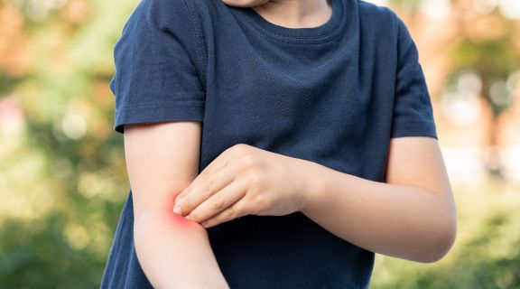 Qual a melhor pomada para picada de inseto em bebê e como aplicar